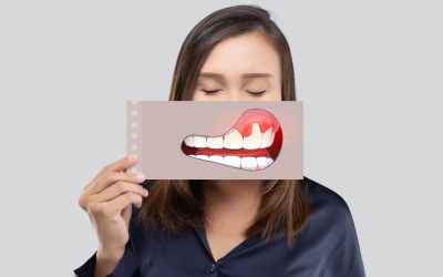 Recognize the Signs of Gum Disease