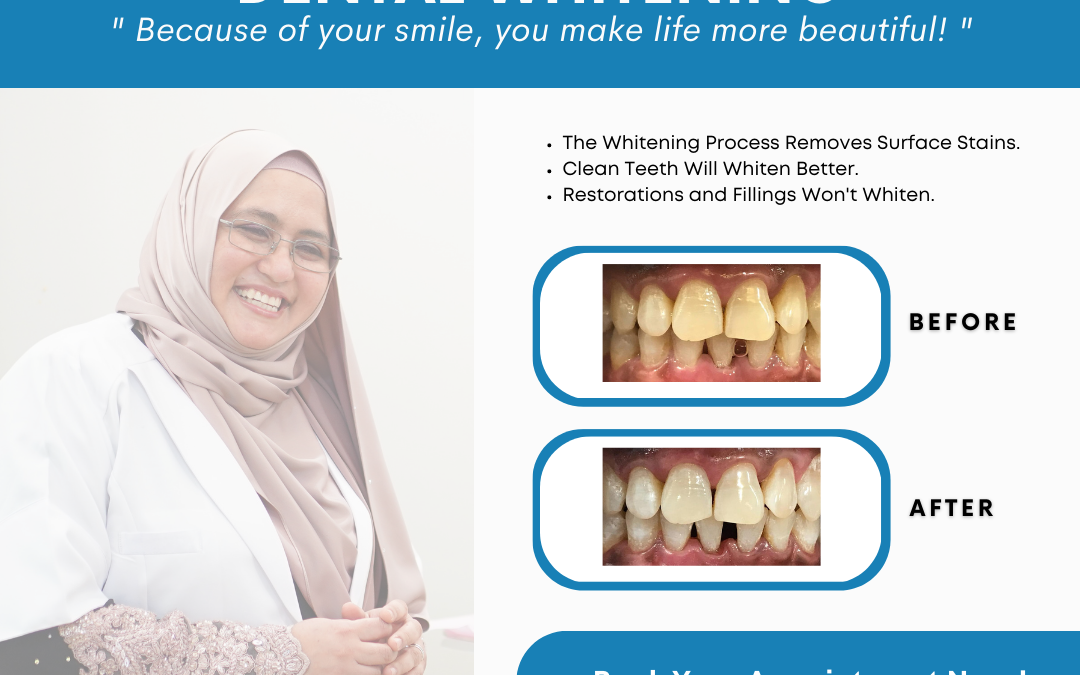 DENTAL WHITENING